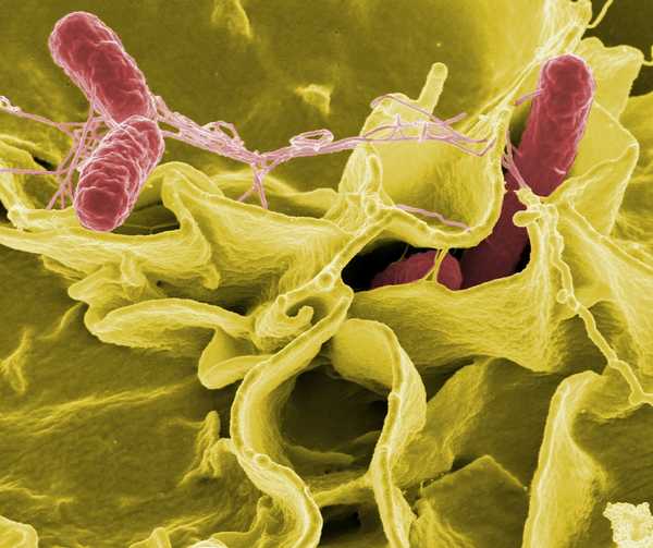 Microrganismi pericolosi - Salmonella microscopio